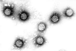 Mannleg papillomavirus